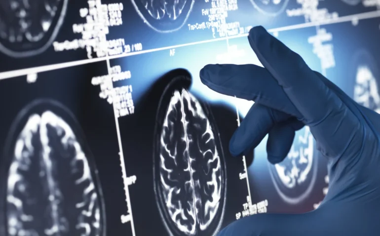 neurology-research-doctor-examining